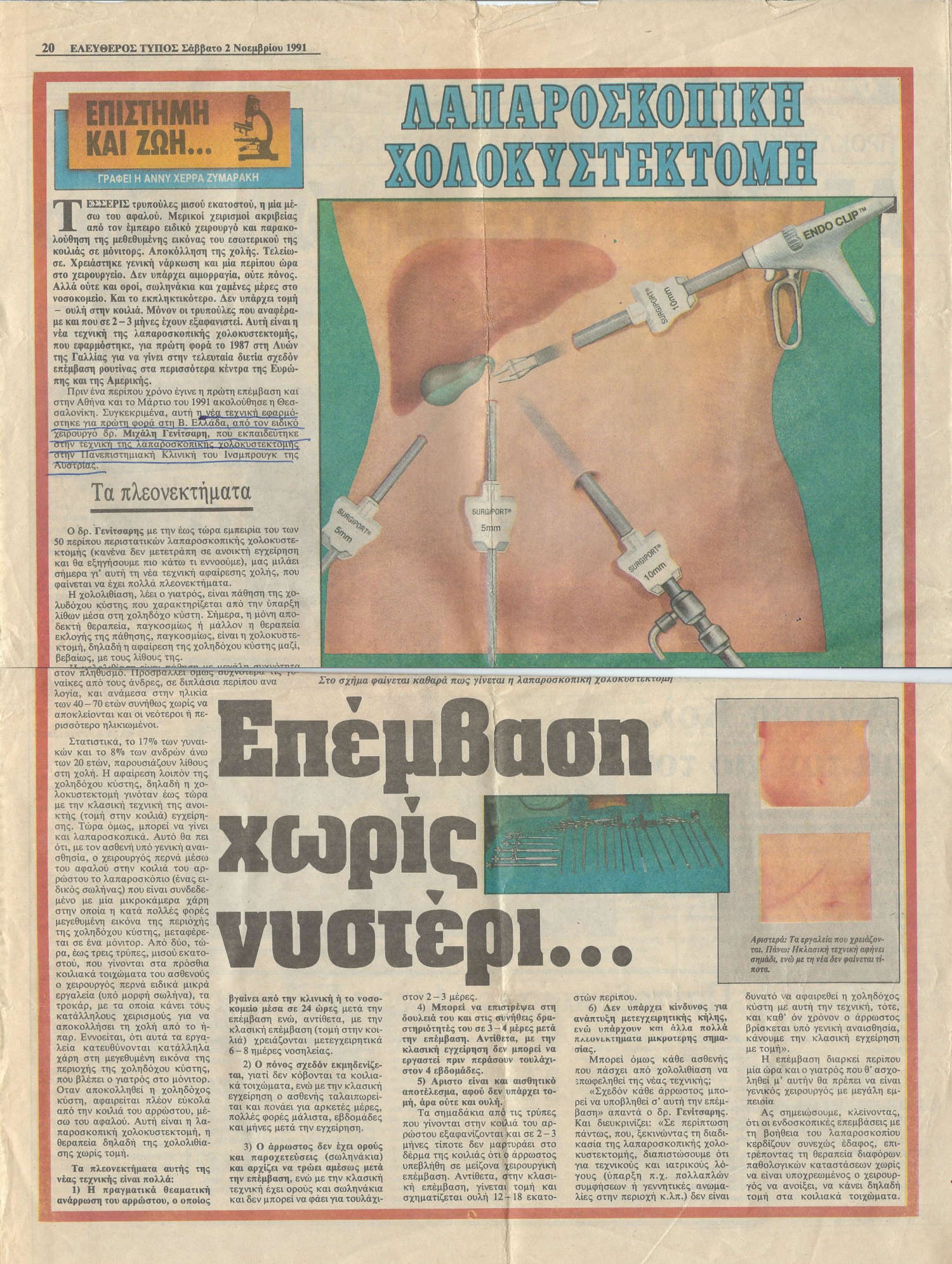 Λαπαροσκοπική Χολοκυστεκτομή - «Ελεύθερος Τύπος», 2 Νοεμβρίου 1991